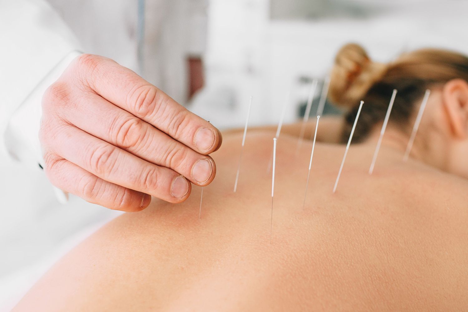 Huang Wellness Center offers acupuncture care for northern Virginia communities