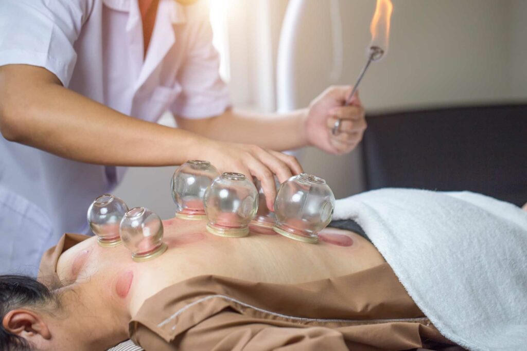 Cupping therapy is used to create space between the fascia and muscle, allowing for better circulation and detoxification.